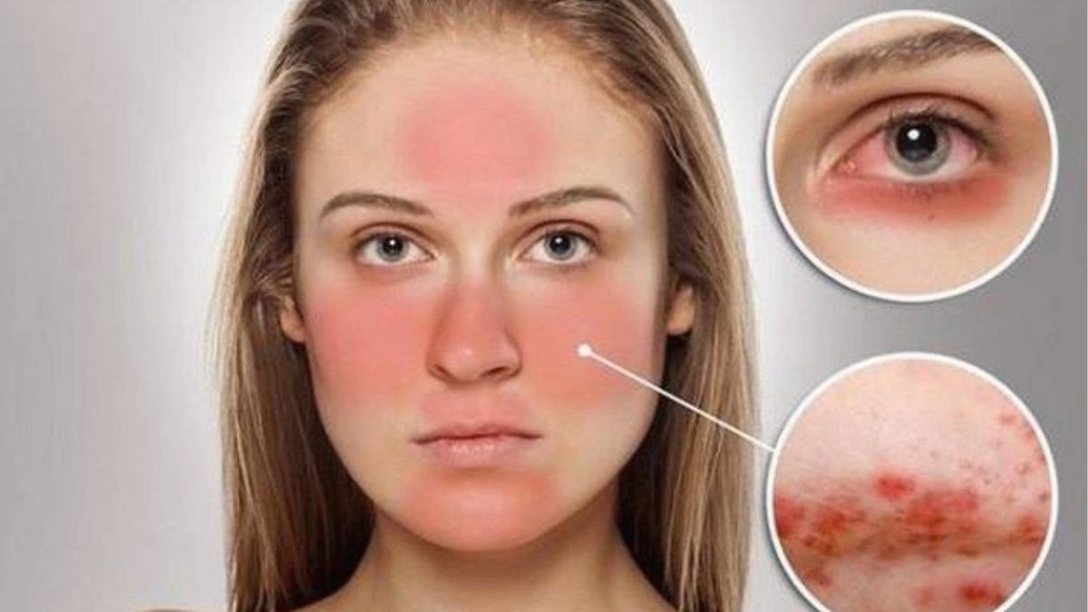 Da nhạy cảm là gì?