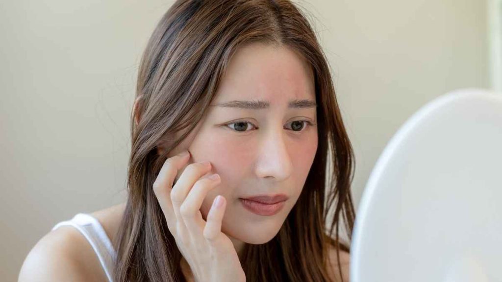 Trong giai đoạn da đang phục hồi, bạn nên tránh chà xát mạnh hoặc sờ tay lên mặt để tránh vi khuẩn từ tay xâm nhập và gây nhiễm trùng
