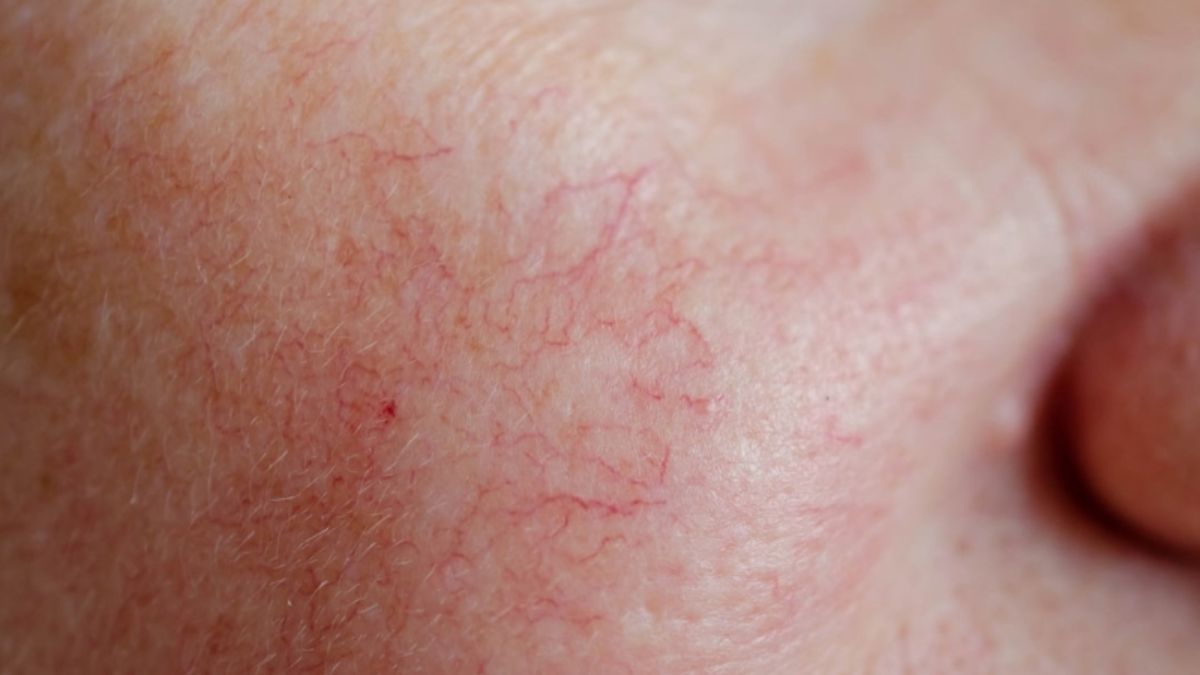 Mao mạch là gì? Tìm hiểu cấu trúc, chức năng và cách bảo vệ