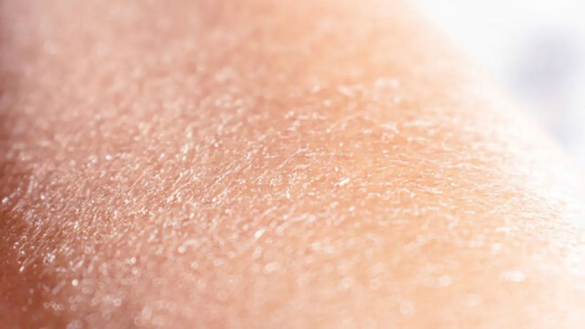 Nguyên nhân khiến da khô nghiêm trọng hơn vào mùa đông