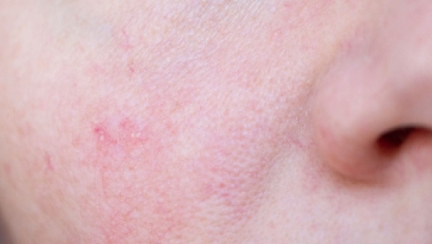 Nên chăm sóc định kỳ 2 lần/tuần để duy trì làn da khoẻ