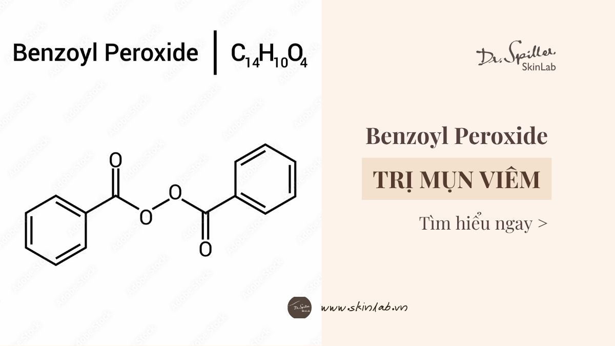 Benzoyl Peroxide trị mụn viêm: Có thật sự hiệu quả?