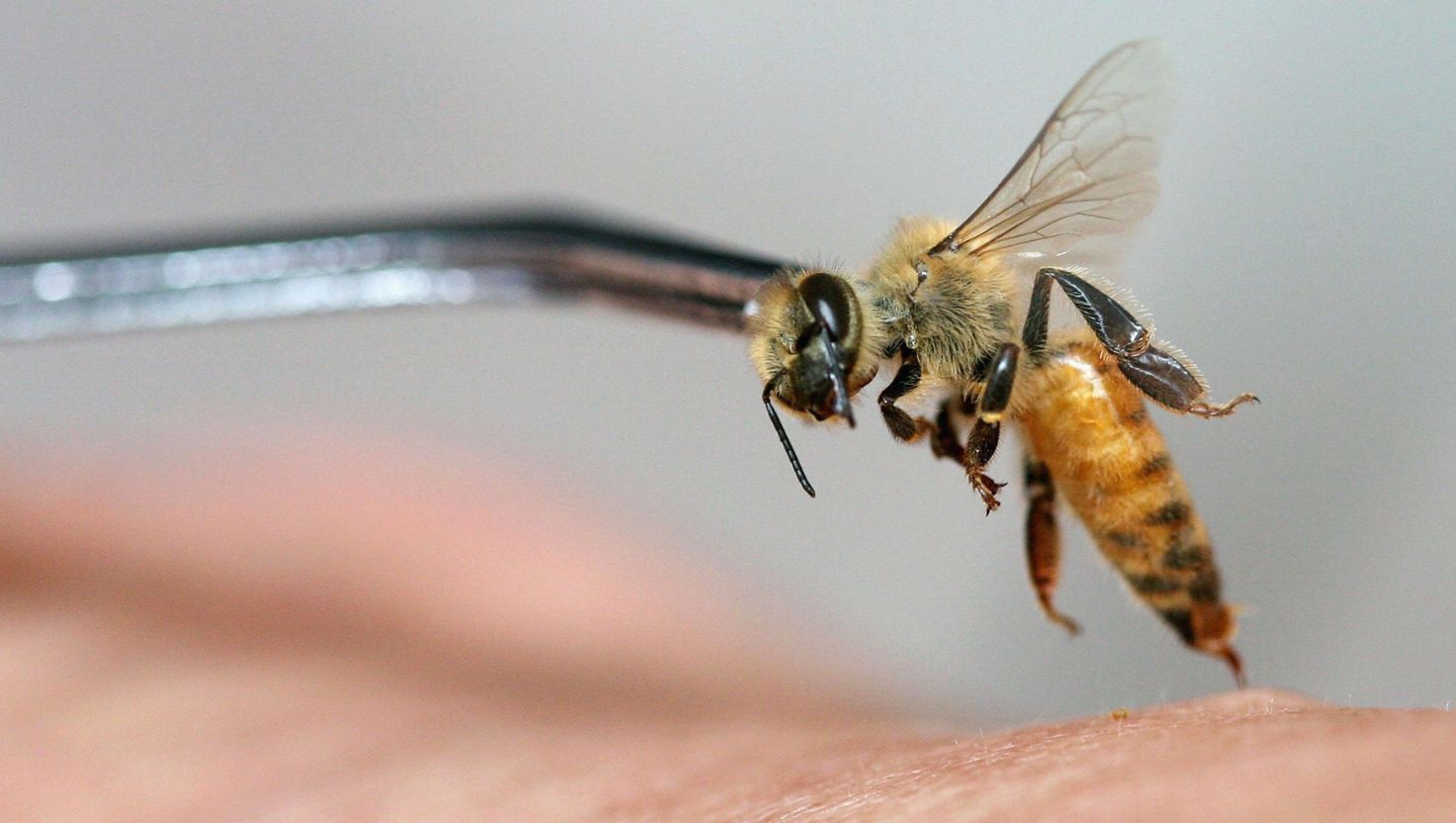 Bị ong đốt bôi gì?