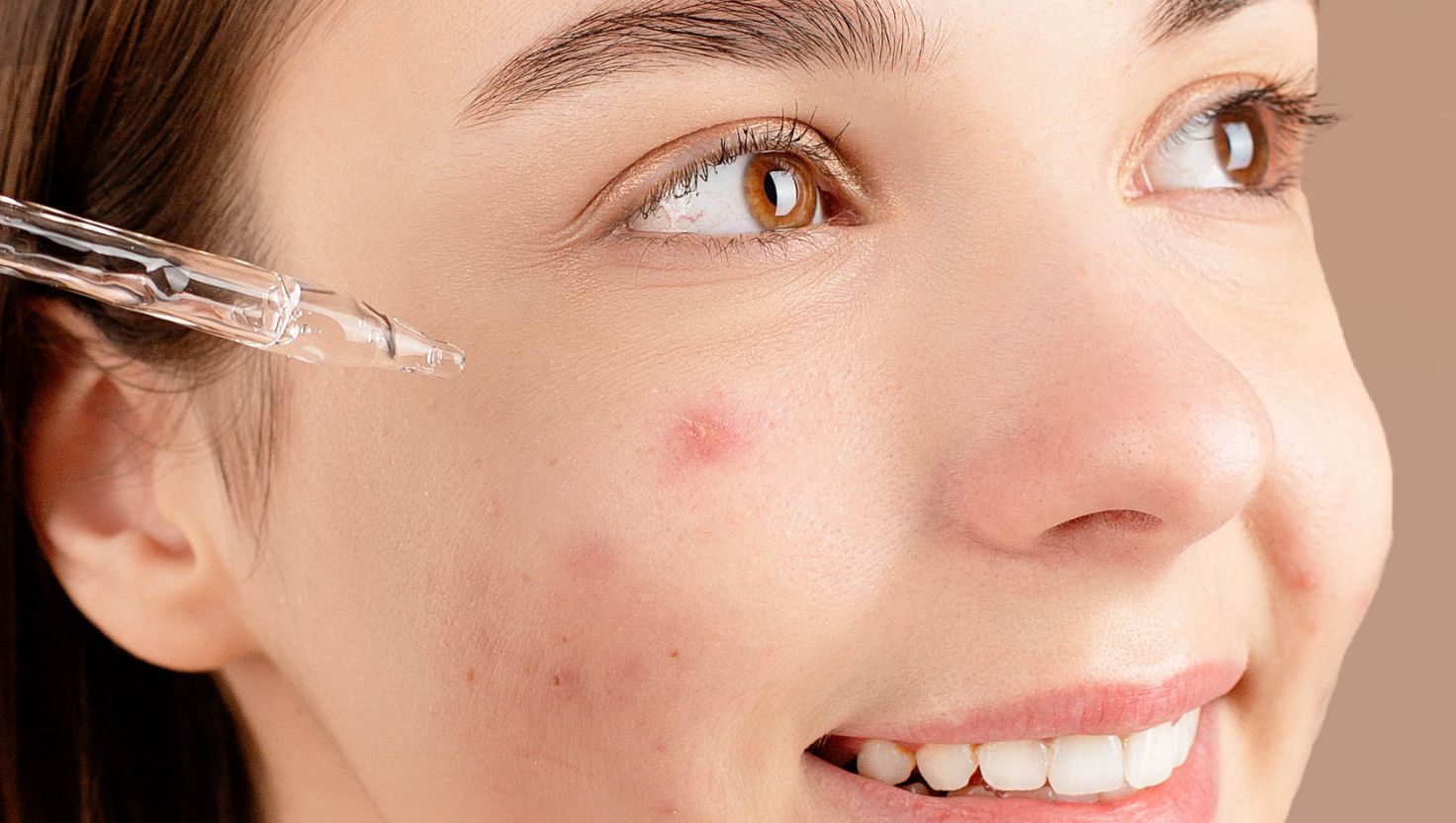 Serum dành cho da mụn thường có thành phần kháng viêm, kháng khuẩn