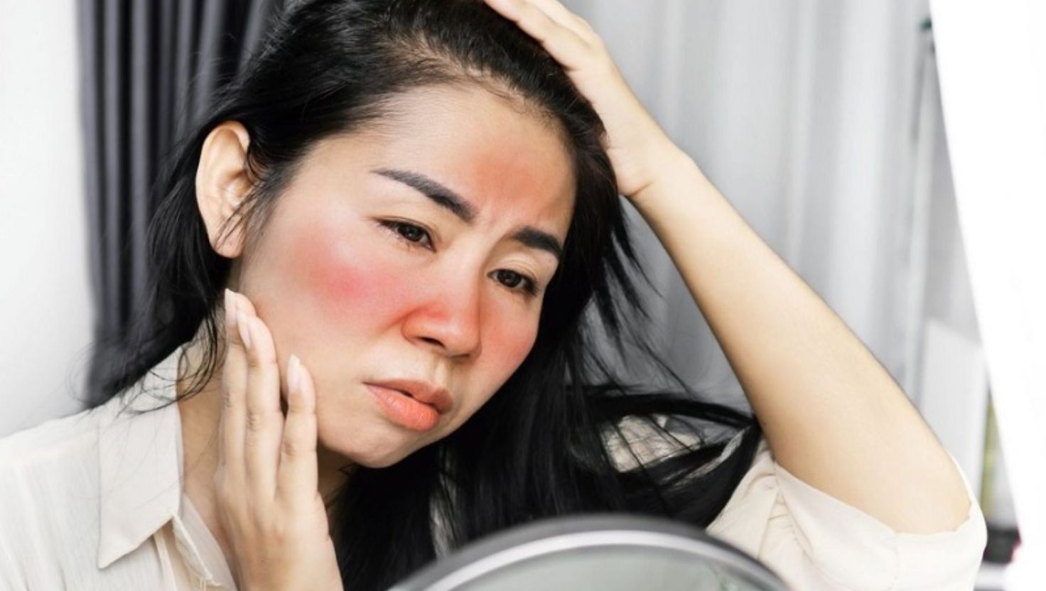 Cách chữa cháy nắng hiệu quả ngay tại nhà
