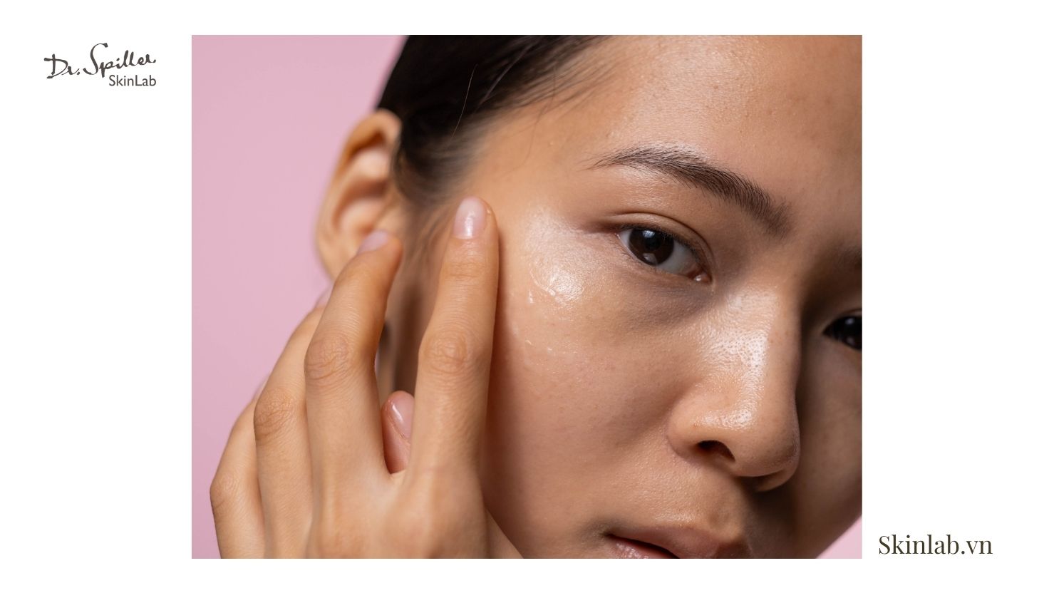 Nguyên nhân khiến da tiết dầu quá mức