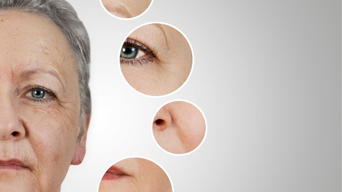 Nguyên nhân do lão hoá hình thành nếp nhăn sống mũi