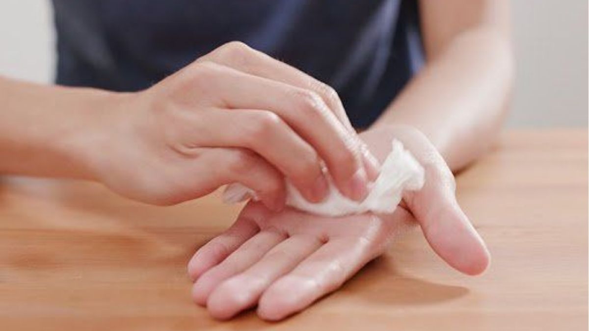 3+ Cách trị mồ hôi tay đơn giản, hiệu quả và an toàn tại nhà