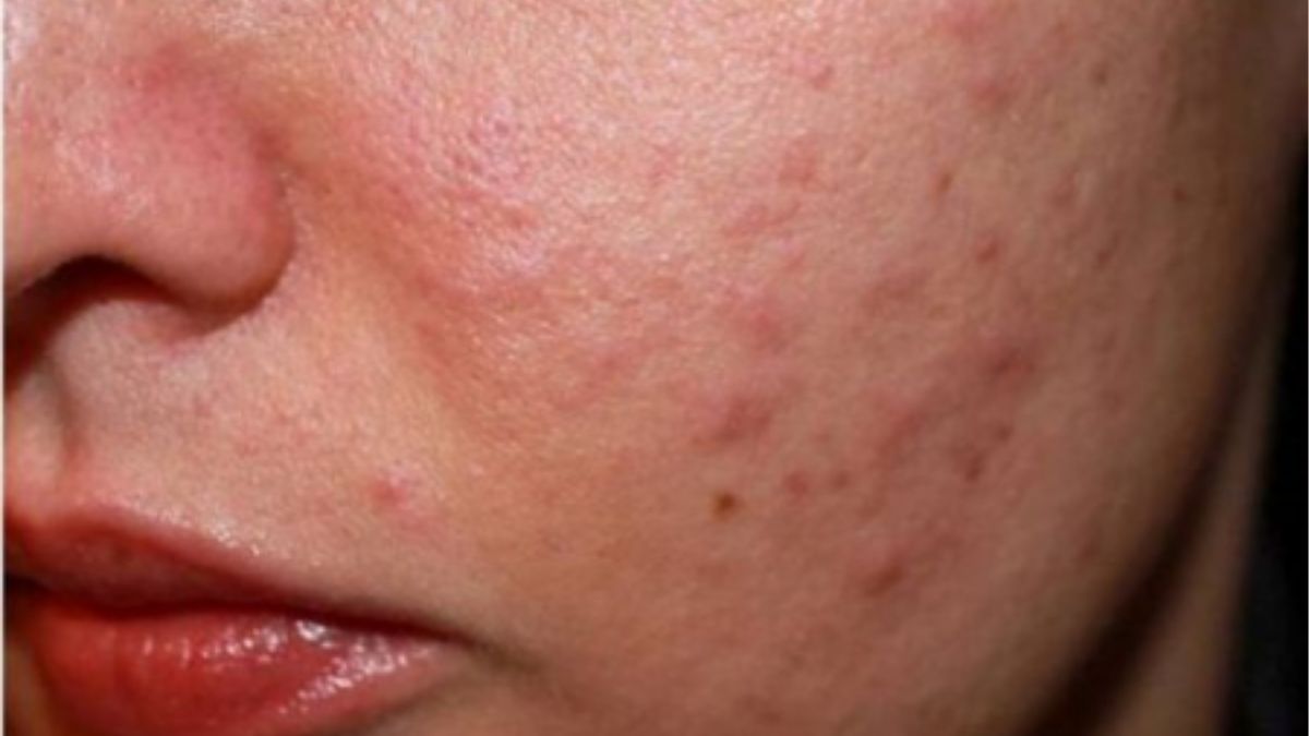 Khi nào cần gặp bác sĩ chuyên khoa da liễu?