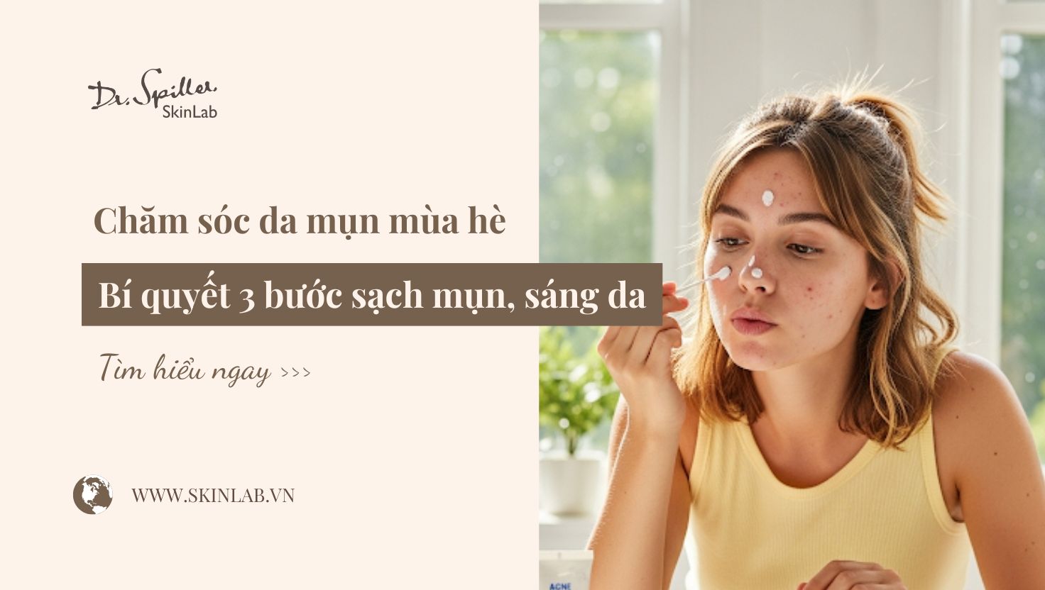 Chăm sóc da mụn mùa hè: Bí quyết 3 bước sạch mụn, sáng da