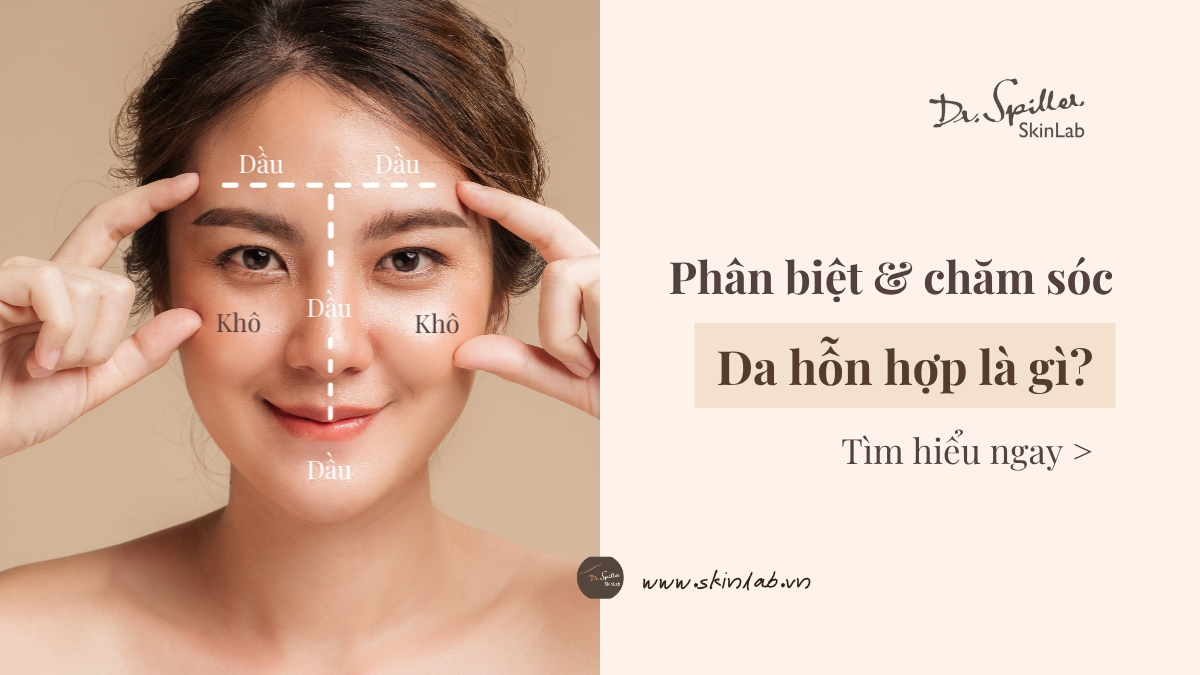 da hỗn hợp là gì