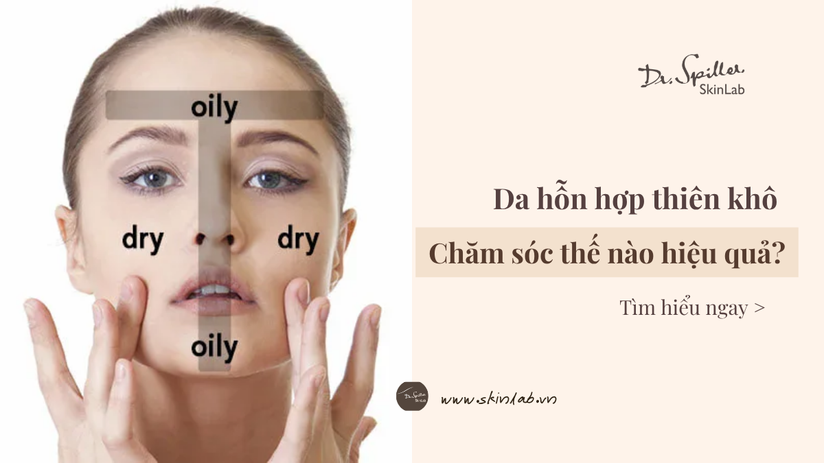 Cách chăm sóc da hỗn hợp thiên khô hiệu quả, đúng khoa học