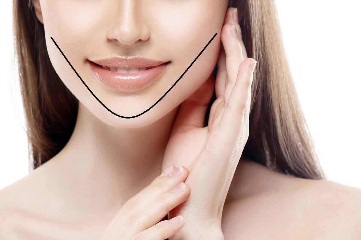 Ngược lại với vùng chữ T, vùng chữ U thường có đặc điểm của da thường hoặc da khô