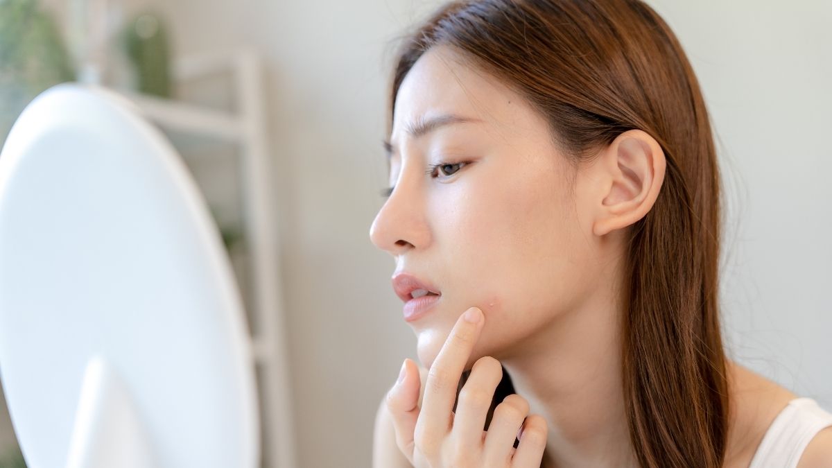 Đặc điểm nhận biết làn da nhạy cảm