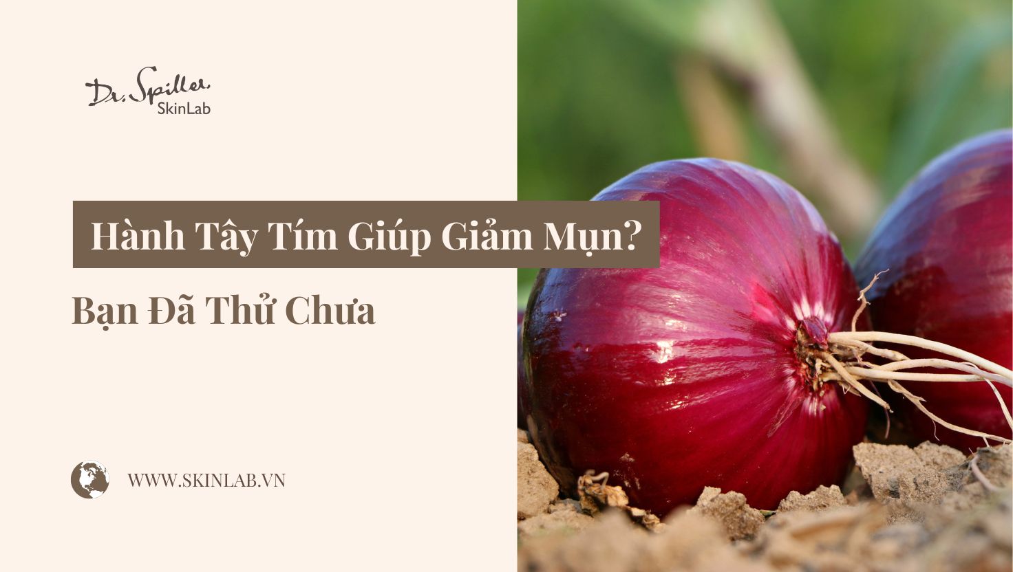 Hành Tây Tím Giúp Giảm Mụn Hiệu Quả, Làm Sạch Da Tự Nhiên