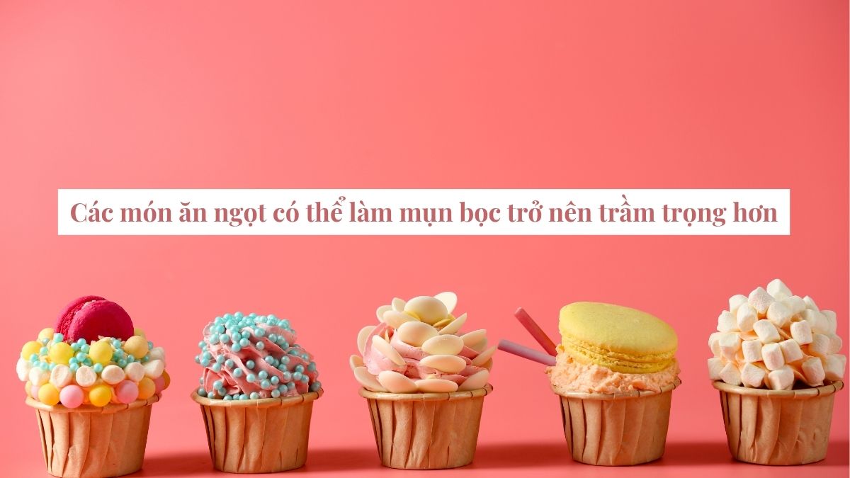 Nên kiêng ăn thực phẩm chứa nhiều đường và carbohydrate tinh chế khi bị mụn bọc