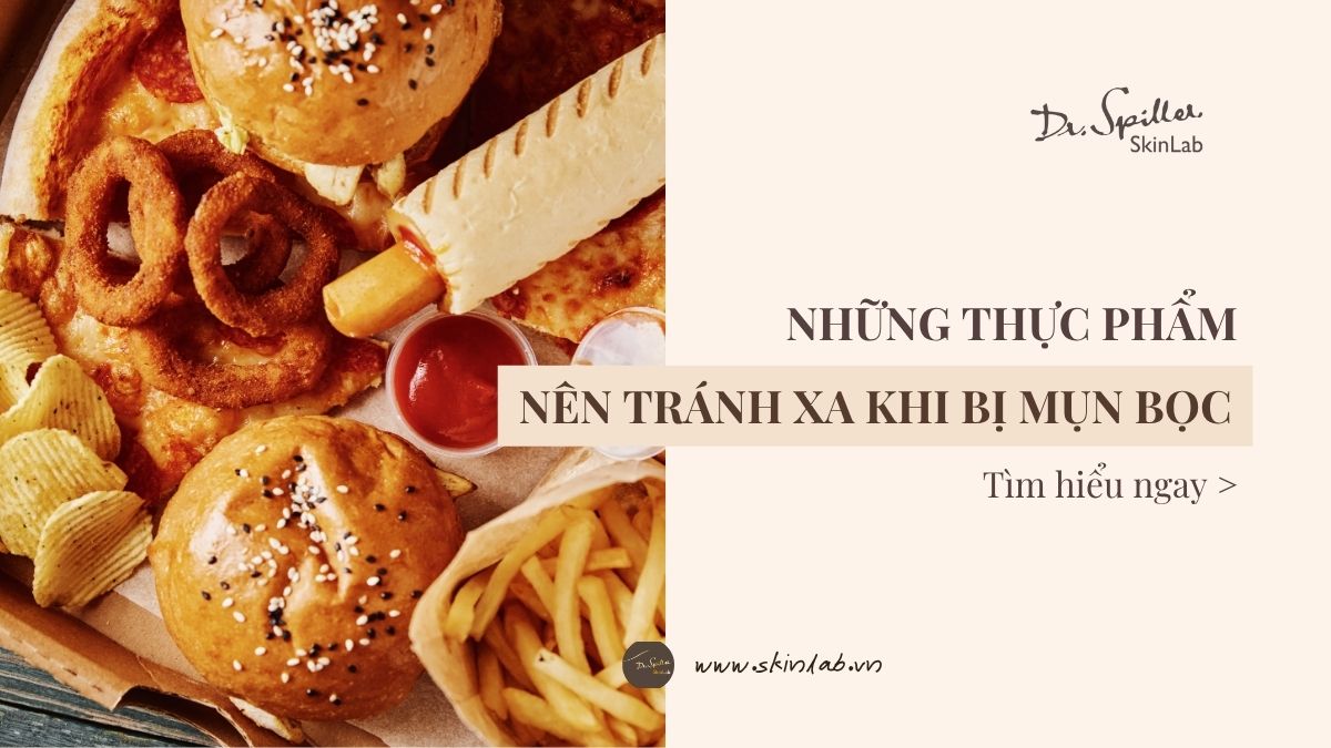 Bị mụn bọc? Tránh xa top 5 thực phẩm gây mụn.