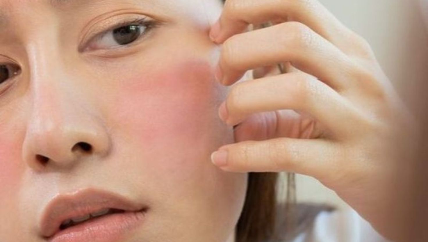 Đặc điểm nhận diện làn da cơ thể nhạy cảm