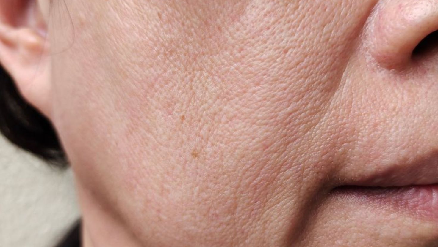 Nguyên nhân gây da mặt chảy xệ