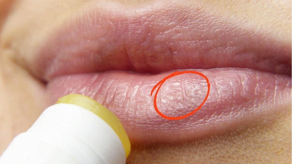 Dùng sản phẩm dưỡng môi chuyên dụng