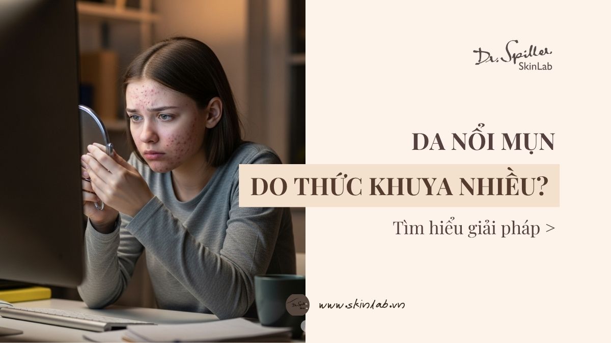 Mụn do thức khuya nhiều: Giải pháp nào hiệu quả?