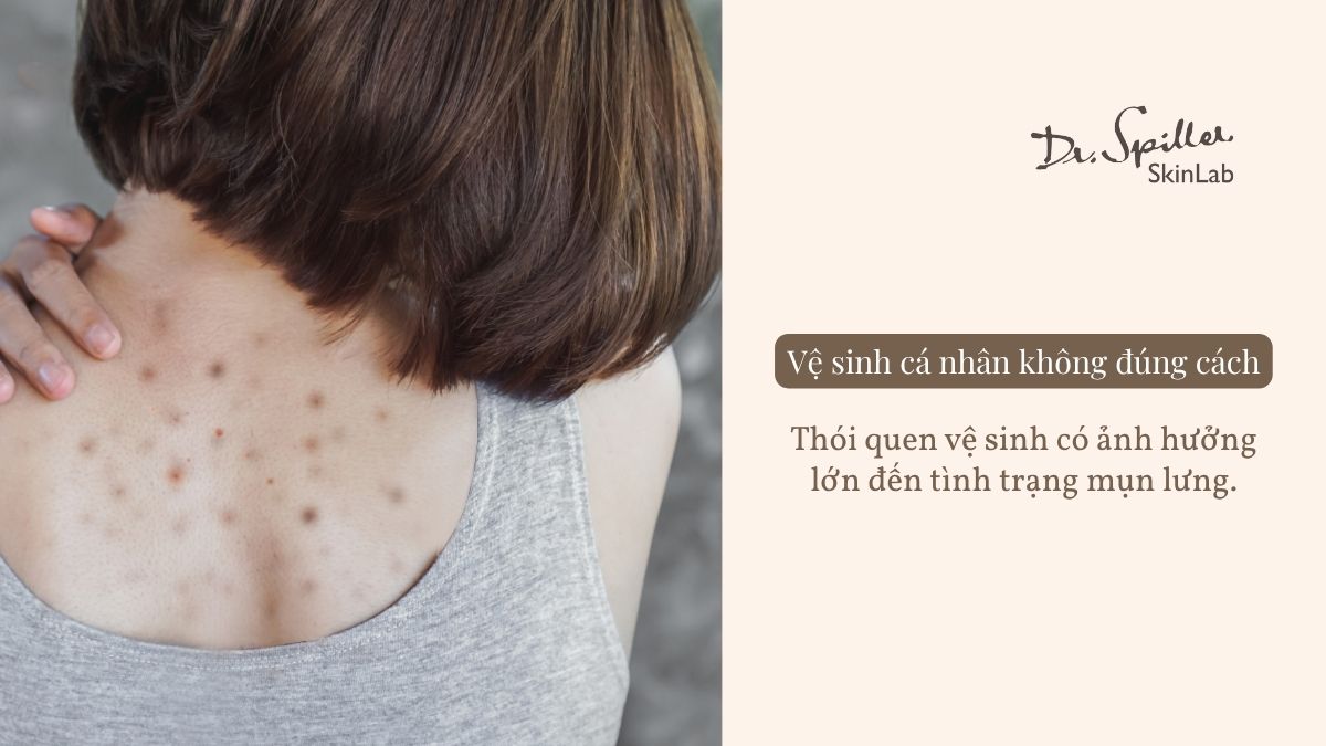 Thói quen vệ sinh có ảnh hưởng lớn đến tình trạng mụn lưng.