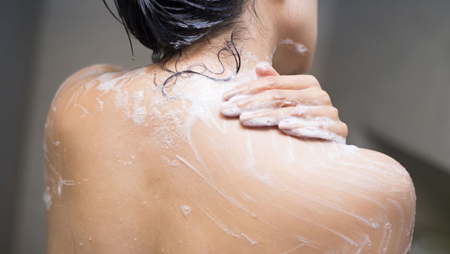 Cách điều trị mụn trứng cá ở vai hiệu quả