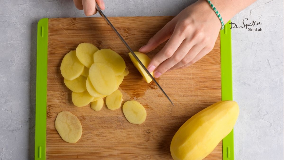 Khoai tây chứa enzyme catecholase giúp làm sáng da tự nhiên, giúp cải thiện tình trạng nách bị thâm