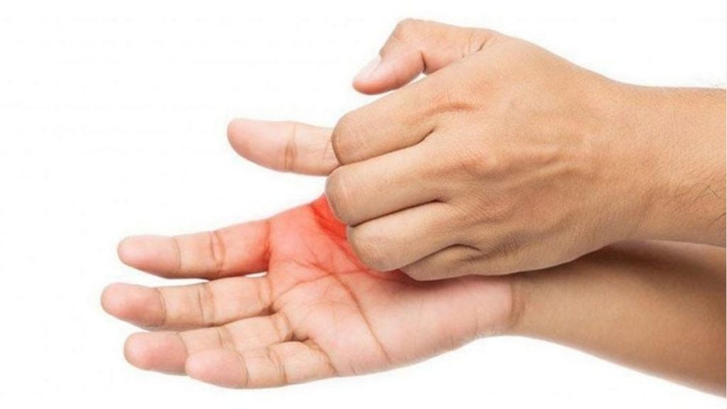 Triệu chứng đi kèm khi ngứa lòng bàn tay, bàn chân