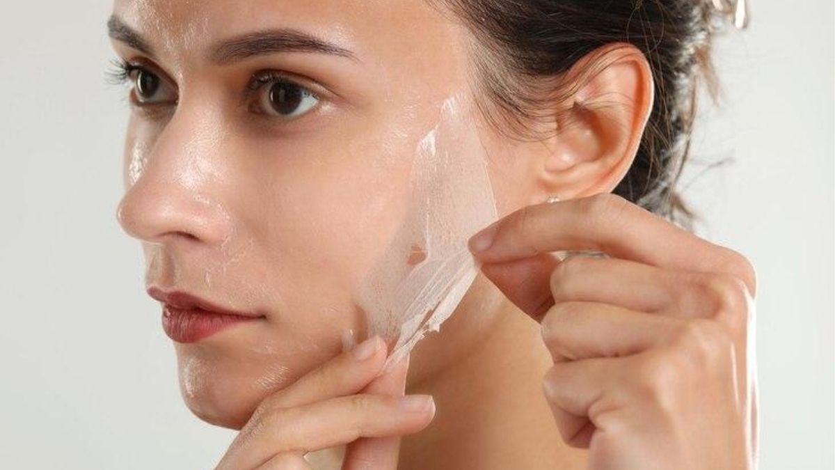 Các cấp độ peel da trị mụn phổ biến hiện nay