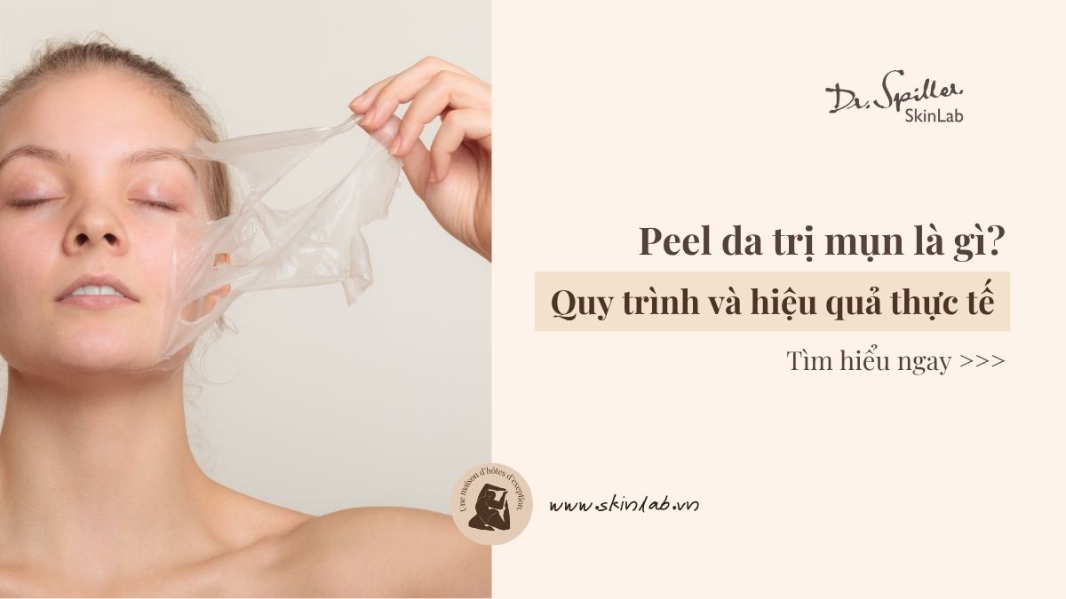 Peel da trị mụn là gì? Quy trình và hiệu quả thực tế