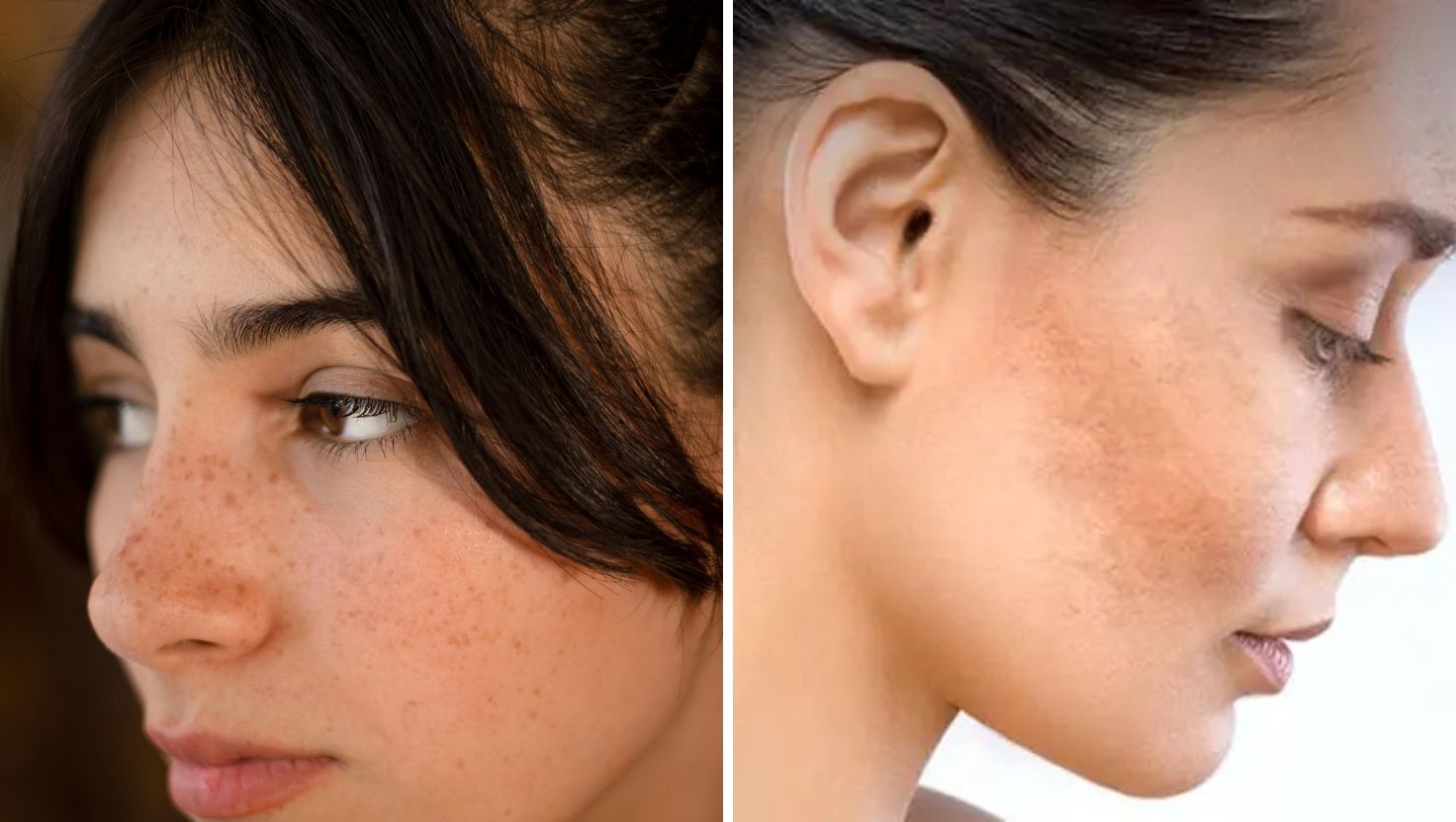 Cách nhận diện bằng mắt thường: Phân biệt chính xác để điều trị hiệu quả