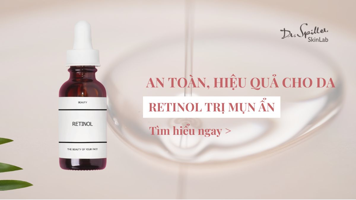Retinol trị mụn ẩn