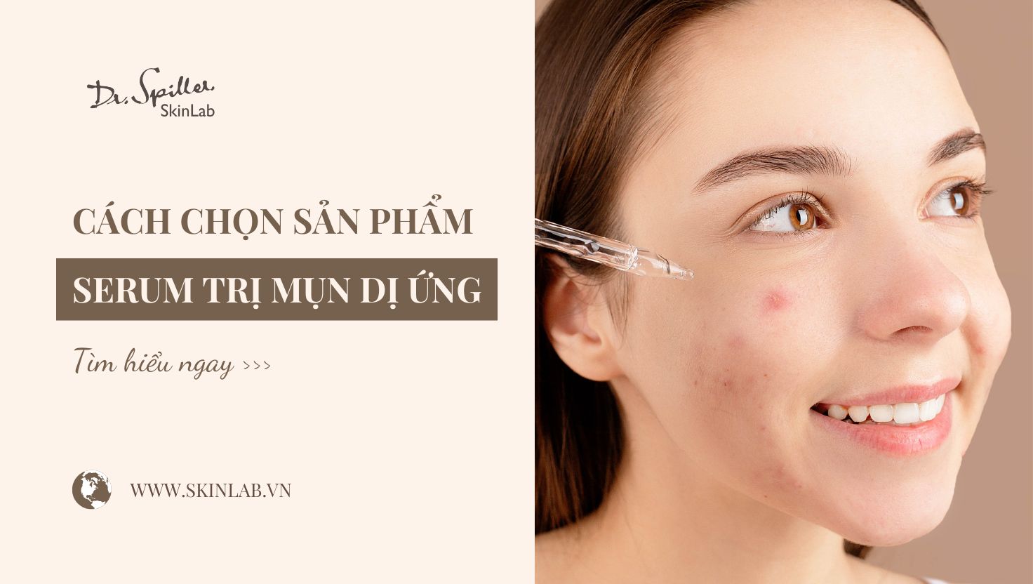 Serum trị mụn dị ứng có thực sự cần thiết?
