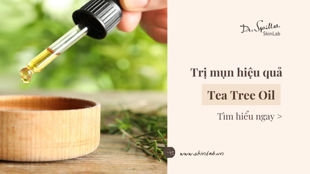 Tea Tree Oil trị mụn hiệu quả an toàn cho da dầu mụn