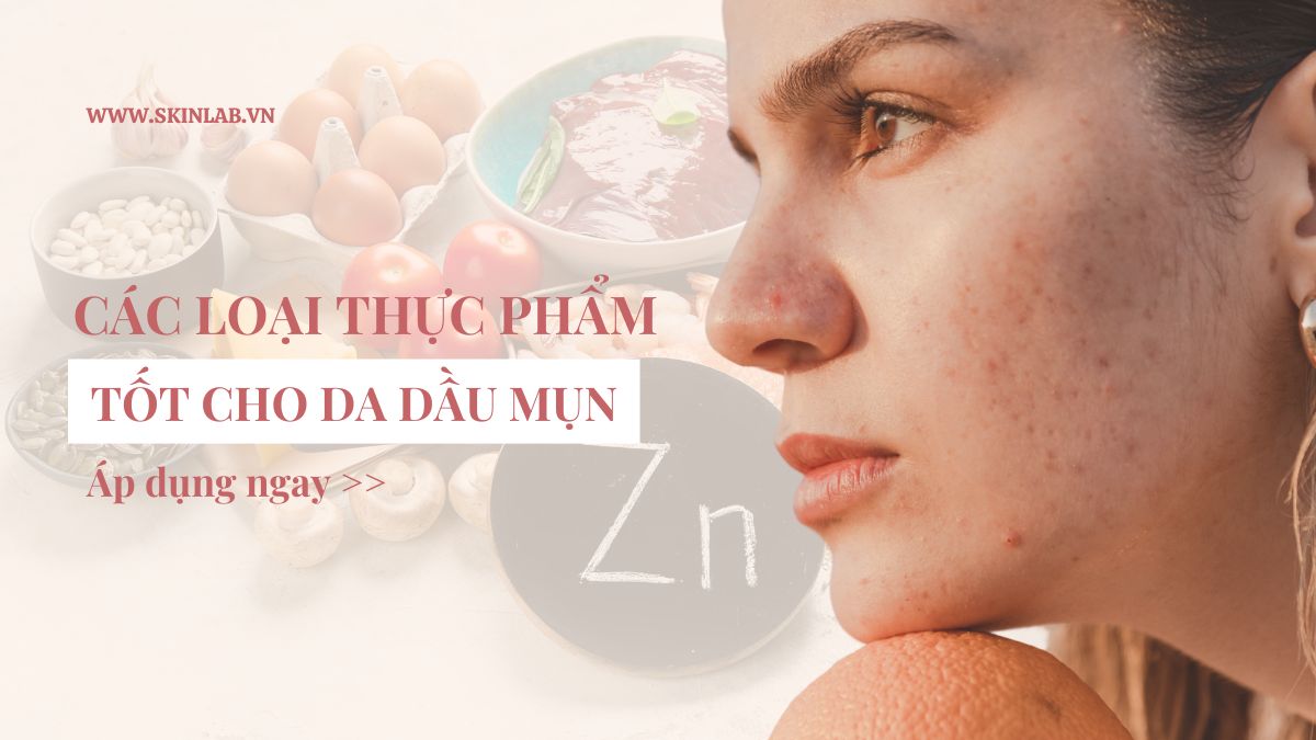 Thực phẩm tốt cho da dầu mụn giúp giảm nhờn, ngừa mụn