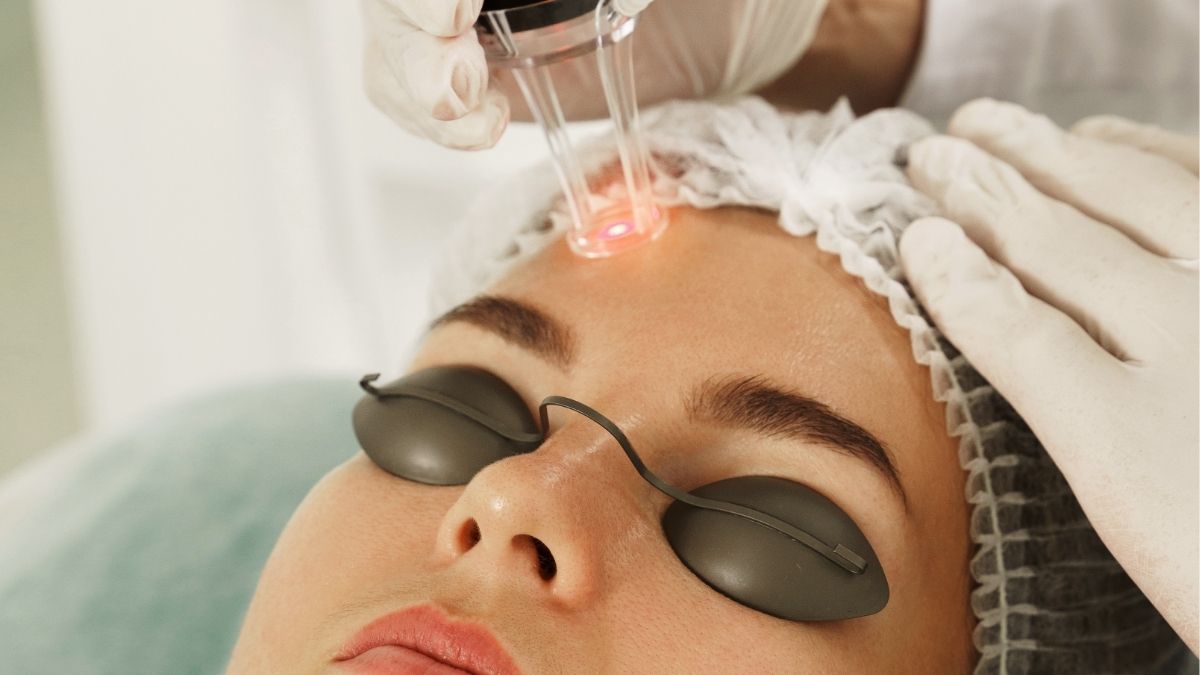 Công nghệ laser fractional CO2 trẻ hoá làn da