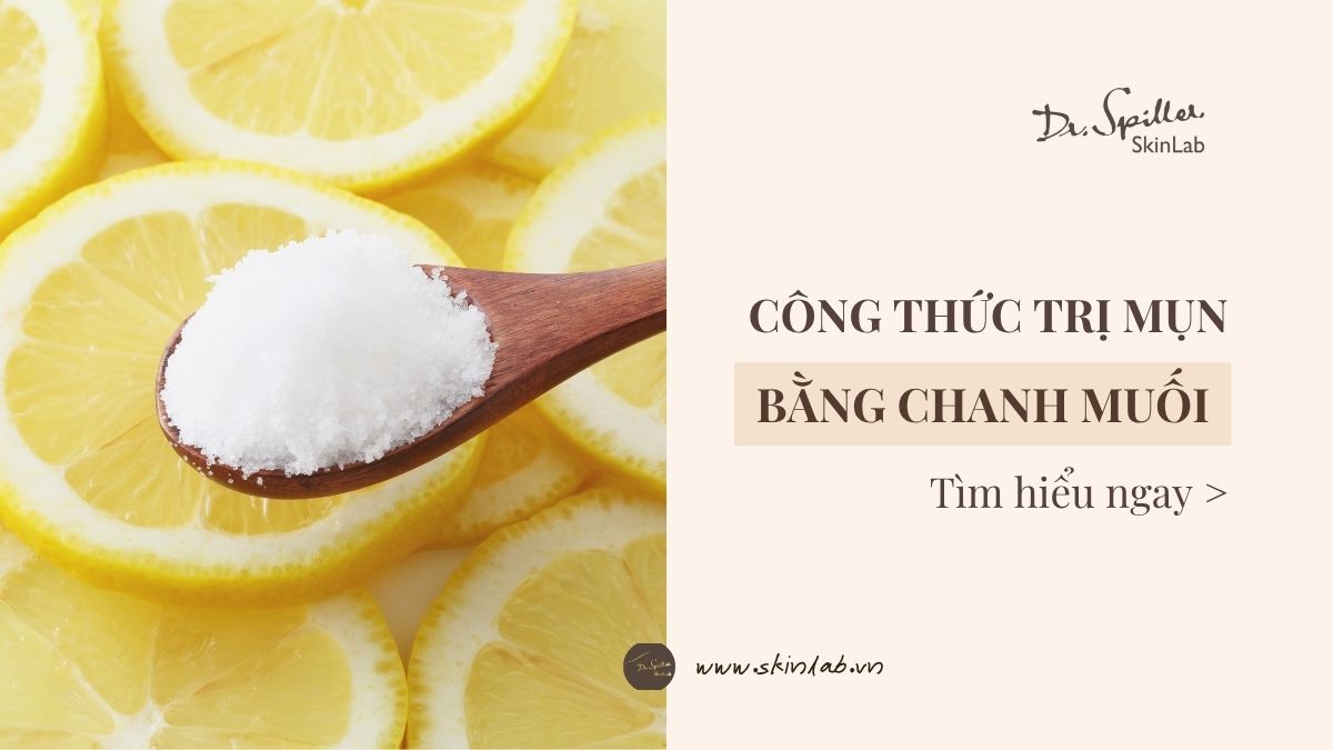 Trị mụn bằng chanh và muối: Hiệu quả bất ngờ tại nhà!