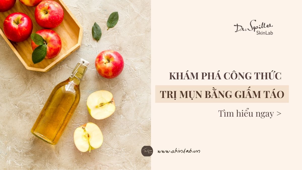 Khám phá công thức trị mụn bằng giấm táo đơn giản tại nhà