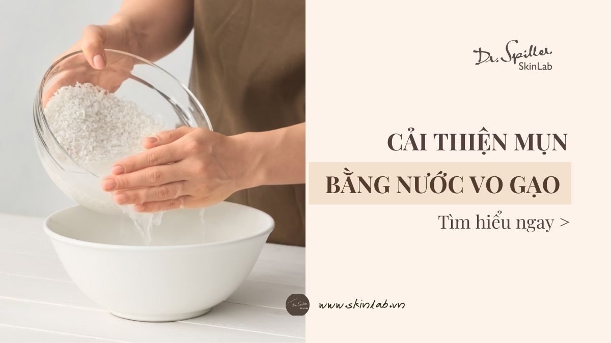 Trị mụn bằng nước vo gạo - Tìm hiểu 3 giải pháp tự nhiên hiệu quả