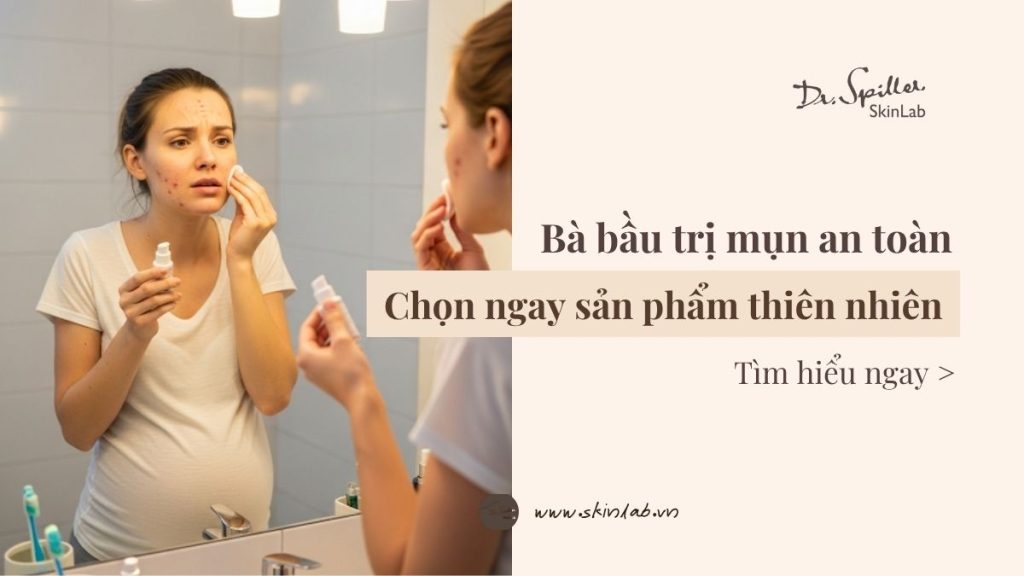 Bà bầu trị mụn an toàn: Chọn ngay sản phẩm thiên nhiên