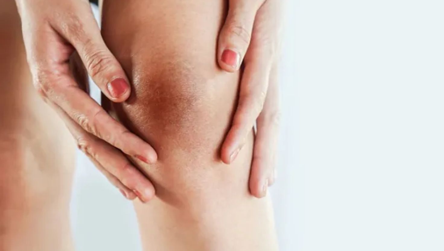 Nguyên nhân phổ biến khiến đầu gối con gái bị thâm