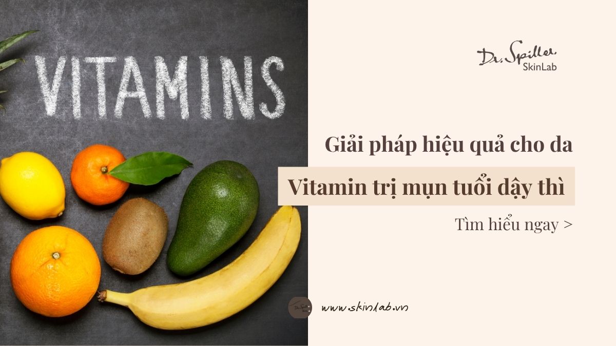 Vitamin trị mụn tuổi dậy thì: Giải pháp hiệu quả cho da