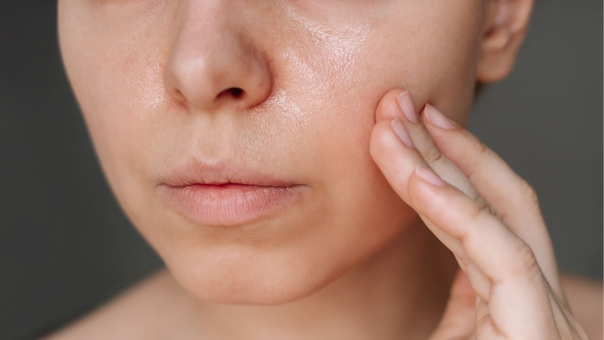 Da dầu hoặc da hỗn hợp thiên dầu chăm sóc vùng chữ T thế nào?