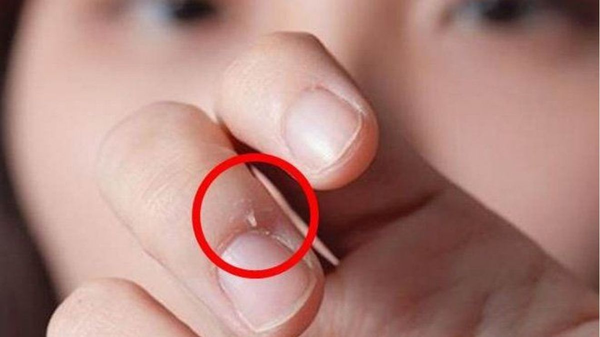 Triệu Chứng Nhận Biết Xước Măng Rô