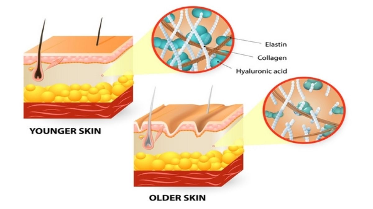 Khi tia UV xuyên qua lớp biểu bì, chúng phá vỡ cấu trúc collagen và elastin