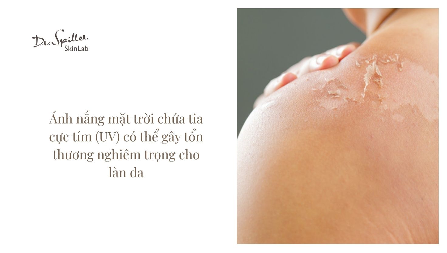 Tác hại của ánh nắng và nước biển đối với làn da