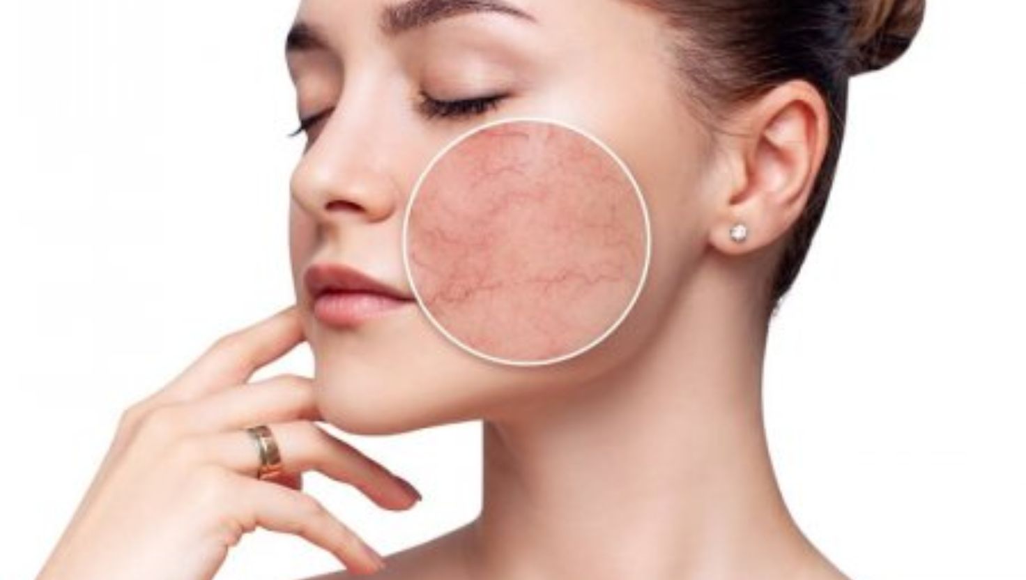 Hướng Dẫn Chăm Sóc Da Nhạy Cảm Hiệu Quả Từ Chuyên Gia