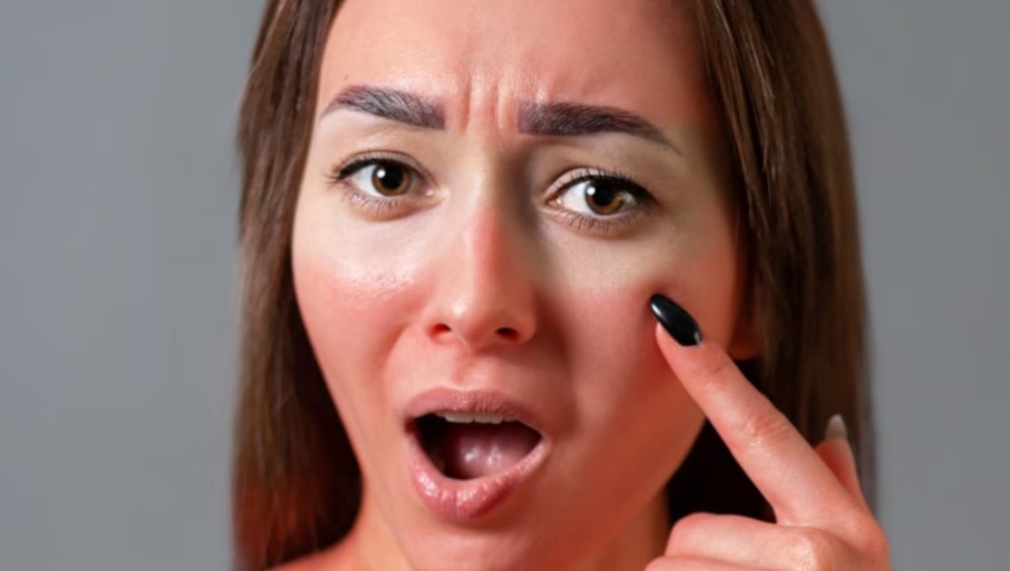 Da nhạy cảm bị cháy nắng – điều gì đang xảy ra?