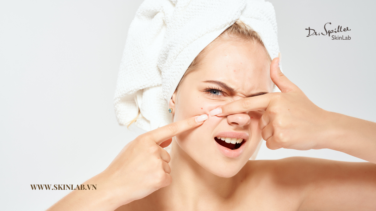Nguyên nhân da trở nên nhạy cảm sau khi nặn mụn